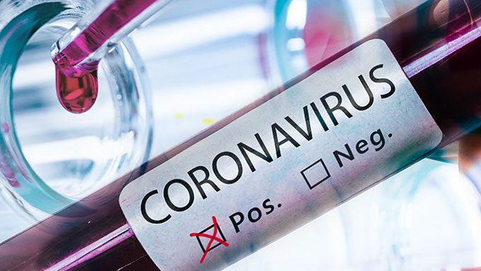 Virus-e-dintorni-coronavirus